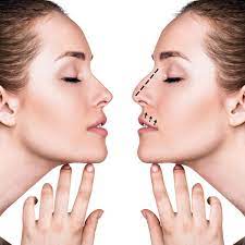 nose, lips Rhinoplasty Surgery in Lahore